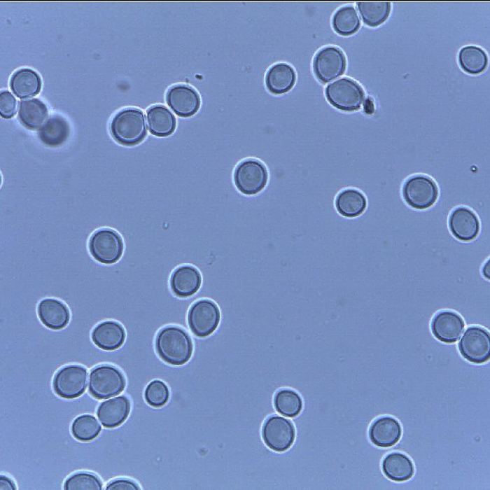Levaduras al microscopio
