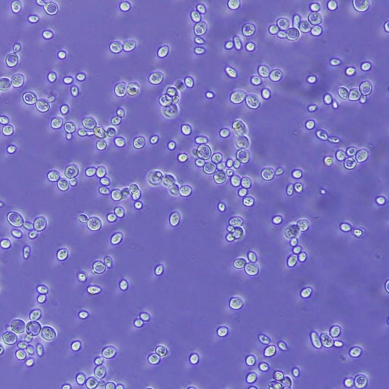 Levaduras vistas al microscopio